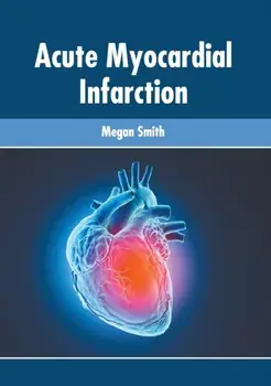 Acute Myocardial Infarction, Hardcover/Megan Smith