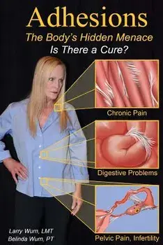 Adhesions: The Body's Inner Menace - Is There a Cure?, Paperback/Larry Wurn Lmt