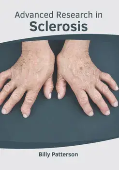 Advanced Research in Sclerosis, Hardcover/Billy Patterson