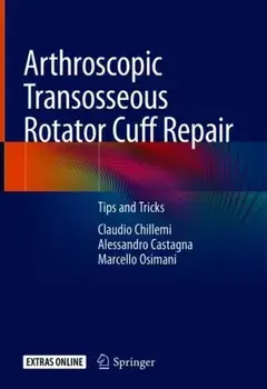 Arthroscopic Transosseous Rotator Cuff Repair. Tips and Tricks, 1st ed. 2018, Hardback/Marcello Osimani