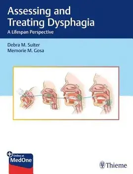 Assessing and Treating Dysphagia: A Lifespan Perspective, Hardcover/Debra Suiter