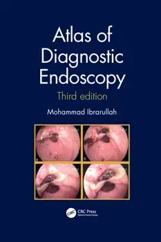 Atlas of Diagnostic Endoscopy, 3E. 3 ed, Paperback/***