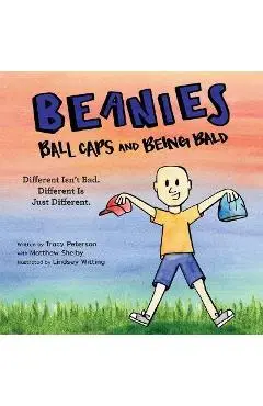 Beanies, Ball Caps, and Being Bald: Different Isn't Bad, Different Is Just Different - Tracy Peterson