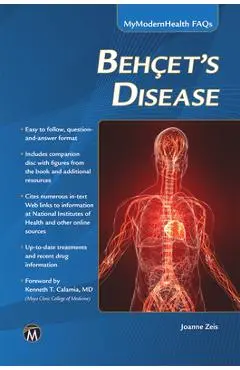 Behcet's Disease - Joanne Zeis