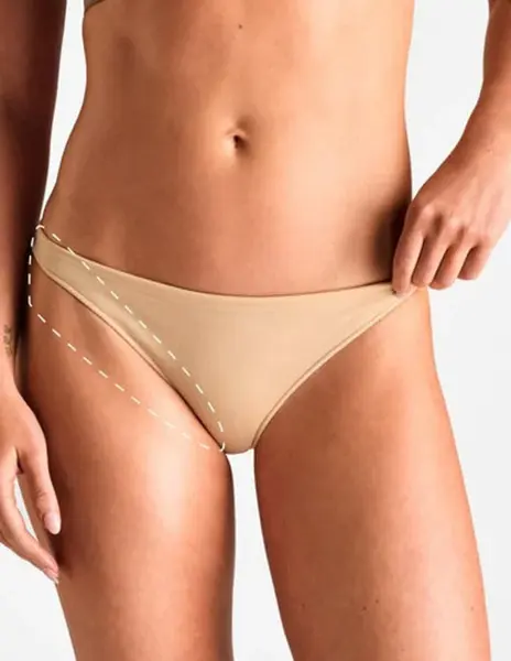 Bikini feminin extins – Epilare Definitivă cu Laser - 1 Sedinta