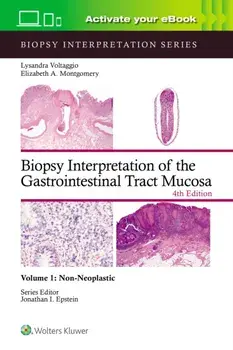 Biopsy Interpretation of the Gastrointestinal Tract Mucosa Volume 1. Non-Neoplastic: Print + eBook with Multimedia, 4 ed, Hardback/ELIZABETH ANNE MONTGOMERY