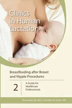 Breastfeeding after Breast and Nipple Procedures: A Guide for Healthcare Professionals, Paperback/Elliot M. Hirsch