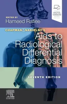 Chapman & Nakielny's Aids to Radiological Differential Diagnosis, Paperback/***