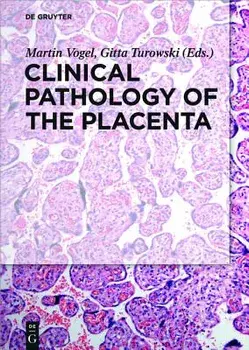 Clinical Pathology of the Placenta, Hardcover/Martin Vogel