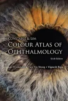 Constable & Lim Colour Atlas of Ophthalmology (Sixth Edition), Paperback/Ian J. Constable