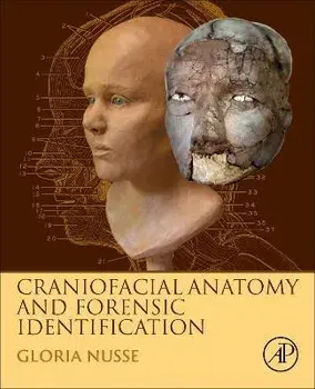 Craniofacial Anatomy and Forensic Identification, Hardback/***