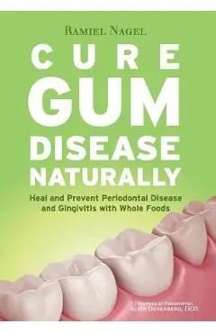 Cure Gum Disease Naturally: Heal Gingivitis and Periodontal Disease with Whole Foods - Ramiel Nagel