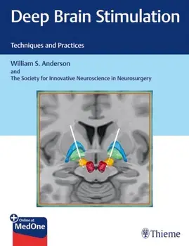 Deep Brain Stimulation. Techniques and Practices, Hardback/The Society For Innovative Neuroscience