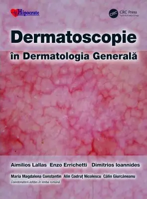 Dermatoscopie in Dermatologia Generala