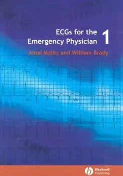 ECGs for the Emergency Physician 1, Paperback/Amal Mattu