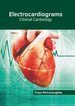 Electrocardiograms: Clinical Cardiology, Hardcover/Freya McConaughey