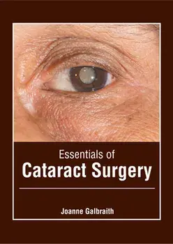 Essentials of Cataract Surgery, Hardcover/Joanne Galbraith