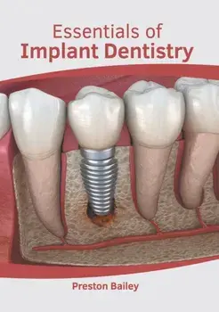 Essentials of Implant Dentistry, Hardcover/Preston Bailey