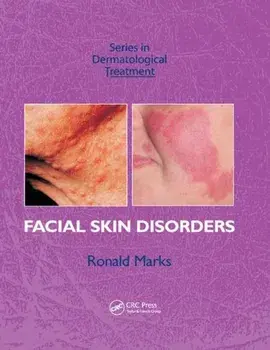Facial Skin Disorders, Paperback/Ronald Marks