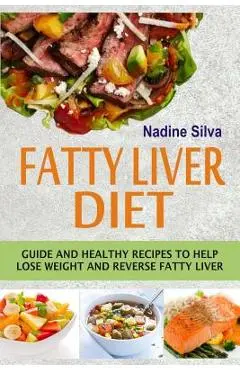 Fatty Liver Diet: Guide And Healthy Recipes To Help Lose Weight And Reverse Fatty Liver - Nadine Silva