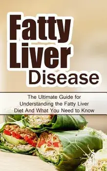Fatty Liver Disease: The Ultimate Guide for Understanding the Fatty Liver Diet and What You Need to Know, Paperback/Wade Migan