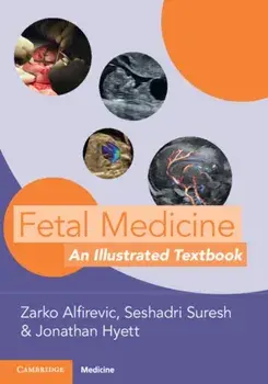 Fetal Medicine. An Illustrated Textbook, Paperback/***