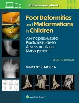 Foot Deformities and Malformations in Children. A Principles-Based, Practical Guide to Assessment and Management: Print + eBook with Multimedia, 2 ed, Hardback/Vincent Mosca