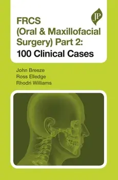 FRCS (Oral & Maxillofacial Surgery) Part 2. 100 Clinical Cases, Paperback/Rhodri Williams