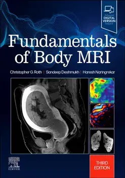 Fundamentals of Body MRI. 3 ed, Paperback/***