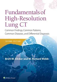 Fundamentals of High-Resolution Lung CT: Common Findings, Common Patterns, Common Diseases and Differential Diagnosis, Paperback/Brett M. Elicker