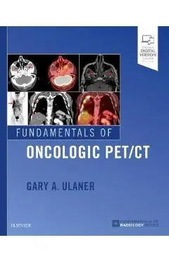 Fundamentals of Oncologic PET/CT - Gary A. Ulaner