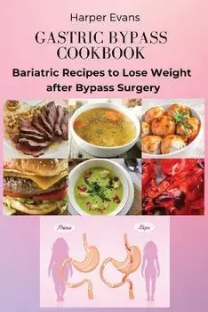 Gastric Bypass Cookbook: Bariatric Recipes to Lose Weight after Bypass Surgery, Paperback/Harper Evans