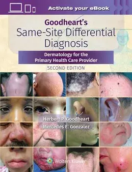 Goodheart's Same-Site Differential Diagnosis. Dermatology for the Primary Health Care Provider, 2 ed, Paperback/Herbert Goodheart