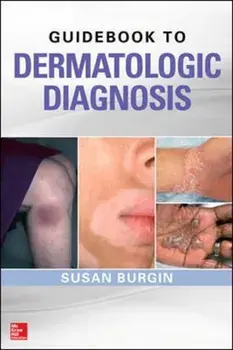 Guidebook to Dermatologic Diagnosis, Paperback/Susan Burgin