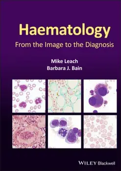 Haematology. From the Image to the Diagnosis, Hardback/Barbara J. Bain