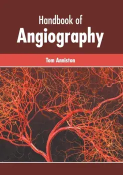 Handbook of Angiography, Hardcover/Tom Anniston