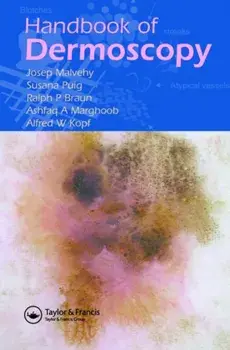 Handbook of Dermoscopy, Paperback/Alfred W. Kopf