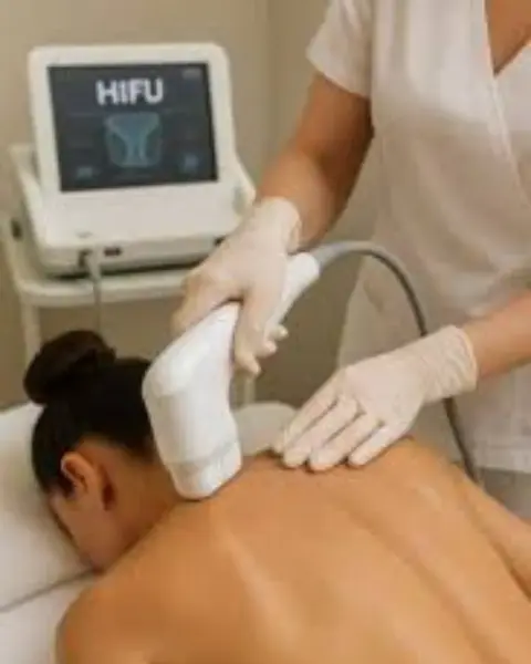 HIFU Spate - 4 Sedinte