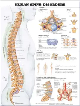 Human Spine Disorders Anatomical Chart. 2 ed/***