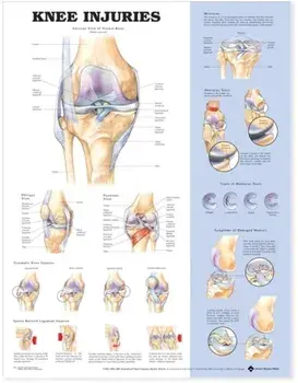 Knee Injuries Anatomical Chart/***