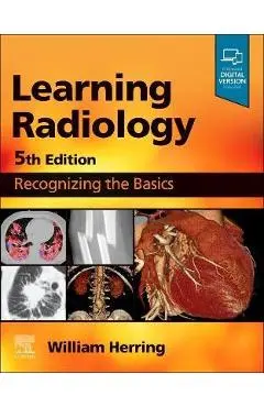 Learning Radiology: Recognizing the Basics - William Herring