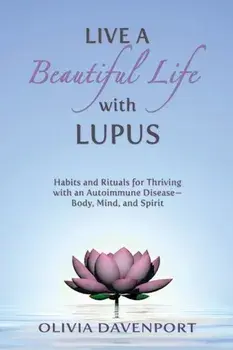 Live a Beautiful Life with Lupus: Habits and Rituals for Thriving with an Autoimmune Disease--Body, Mind, and Spirit, Paperback/Olivia Davenport