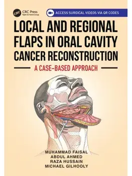 Local and Regional Flaps in Oral Cavity Cancer Reconstruction. A case-based approach, Paperback/Michael Gilhooly