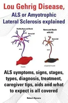 Lou Gehrig Disease, ALS or Amyotrophic Lateral Sclerosis Explained. ALS Symptoms, Signs, Stages, Types, Diagnosis, Treatment, Caregiver Tips, AIDS and, Paperback/Robert Rymore