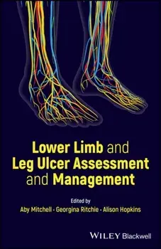 Lower Limb and Leg Ulcer Assessment and Management, Paperback/***