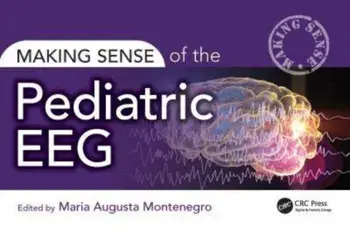 Making Sense of the Pediatric EEG, Paperback/***