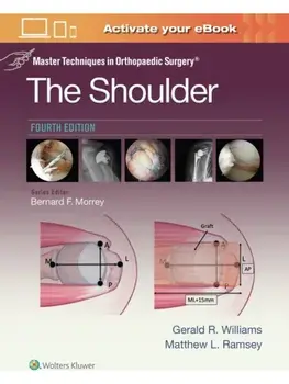 Master Techniques in Orthopaedic Surgery: The Shoulder: Print + eBook with Multimedia. 4 ed, Hardback/MATTHEW L., MD RAMSEY