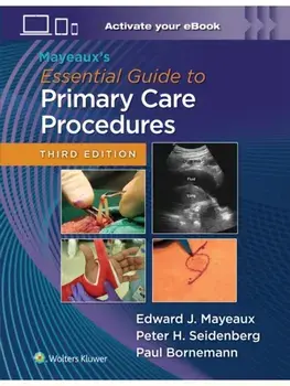 Mayeaux's Essential Guide to Primary Care Procedures: Print + eBook with Multimedia. 3 ed, Hardback/PETER H. SEIDENBERG
