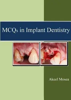 MCQs in Implant Dentistry, Paperback/Akeel Mosea