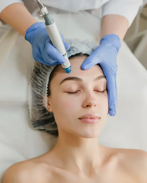 Microneedling – Abdomen - Default Title